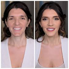 We offer Afterpay for all of our services! Don't miss out