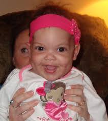 Beautiful Lily, now in God's care. 😢😢😢 thankyou all for your prayers.