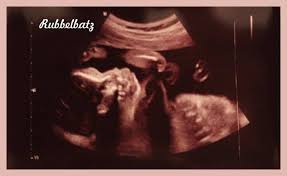 Wann wird das organscreening gemacht? Feindiagnostik In Schwangerschaft Das Erwartet Dich Beim Feinultraschall Rubbelbatz De