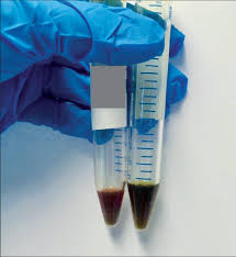 Image result for Modified Apt Test