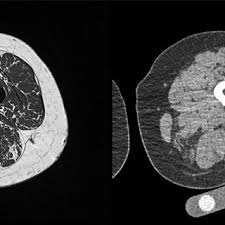 The official practice and training facility of the pittsburgh penguins. Pdf Quantitative Analysis Of Skeletal Muscle By Computed Tomography Imaging State Of The Art