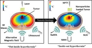 Nanotechnology In Hyperthermia Cancer Therapy From Fundamental Principles To Advanced Applications Sciencedirect