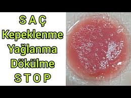 Cilegi Sacina Boyle Sur Sac Dokulmesi Kepeklenme Yaglanma Stop Canli Parlak Sac Icin Cilek Maskesi Youtu Sac Dokulmesi Dogal Saglik Evde Hazirlabilen Ilaclar