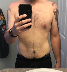 Boc M 23 175lbs 5 10 143lb Loss From Wls Wondering If I Should Boc Wanted To Get Abs And Lose My Belly Fat Loose Skin Bulkorcut
