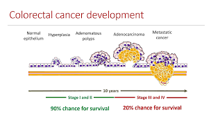 Other probable culprits include a more sedentary lifestyle and unhealthy diets. Colorectal Cancer More People Screened More Lives Saved Biovendor