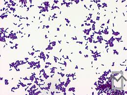 Listeria is a rare but sometimes fatal disease people contract from eating infected food. Pin En Microbiology
