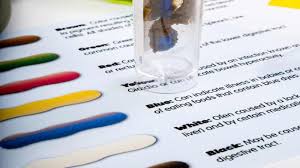 Image result for yellow stool human poop