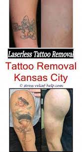 How Do Permanent Tattoos Get Removed How Much Does It Cost To Remove A Small Tattoo Tattoo Removal Right After Ge Kleine Tatowierungen Tatowierungen Diy Tattoo