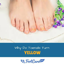 Your toe nails turn yellow as an outcome of fungus infection. Why Do Toenails Turn Yellow Healthier Land