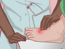 Ketahui penyebab dan cara menghilangkannya tanpa operasi! 3 Cara Untuk Menghentikan Pertumbuhan Bisul Berulang Wikihow