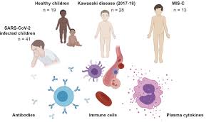 An individual aged <21 years presenting with fever*, laboratory evidence of inflammation**, and evidence of clinically severe illness requiring hospitalization, with multisystem (>2) organ involvement. Eric Topol On Twitter Just Published Cellcellpress Is The Most Extensive Study Of The Immune Response In Covid 19 S Multisystem Inflammatory Syndrome In Children Mis C Https T Co Ghdvwgld8m By Karolinskainst Key Differences V Kawasaki And