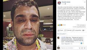 Learn how rich is in this year and how spends money? Evandro Santo Ex Panico Relata Agressao Apos Show Homofobia E Covardia Bauru E Marilia G1