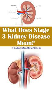 Epingle Sur Kidney Disease Types