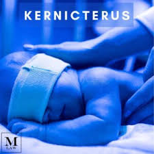 Image result for Kernicterus
