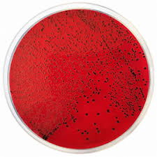Sony will den schon länger nur noch schwach frequentierten treff schließen. Salmonella And Shigella On Xld Agar Shigella And Salmonella Are Colorless And Transparent And Typically Do Not Alter Appearance Of The Medium