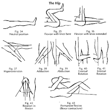 Pin On Mobility For Supple Leopards