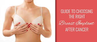 Guide To Choosing The Right Breast Implant After Cancer Sprsi