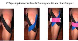 Kinetic Tape For Knees Knee Cap Cap D Agde And Tape On Pinterest Kt Tape Knee Kinesiology Taping Knee Taping