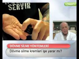 Dovme Silme Muthis Yontem Doktor Acikliyor Youtube