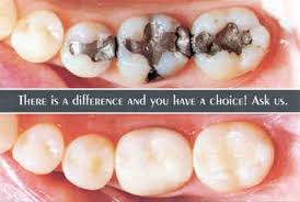 Dental Filling Services Dental Fillings Dental Dentistry