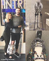 The veteran nfl quarterback suffered a disastrous leg injury that nearly resulted in the loss of his limb. Espn Alex Smith S Wife Elizabeth Had His Leg Brace Made Into A Trophy To Help Remind Them Of How Far They Ve Come Incredible Via Lizbsmith11 Instagram Facebook