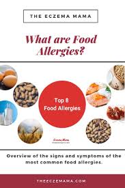 They depend on other organism. What Are Food Allergies Symptoms And Causes Food Allergy Symptoms Common Food Allergies Food Allergies