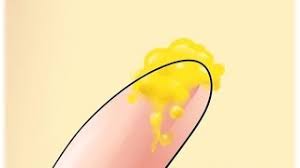 Flujo Vaginal Amarillo Y Sus Causas Youtube