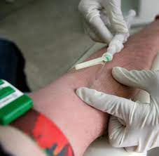 Stirbt man heutzutage noch an hiv? Hiv Test Ist Schon Nach Sechs Wochen Zuverlassig Welt