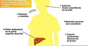 Pin En Hoy Es Noticia En La Guajira