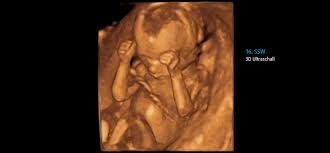 Habt ihr erfahrungen damit ? Praxis Dr Med Mirella Uhden Pranatal Dusseldorf Bildergalerie