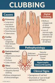 Image result for Digital Clubbing