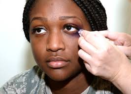Check spelling or type a new query. Awareness Raised Through Black Eye Campaign 59th Medical Wing Article Display