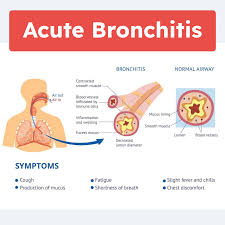 Image result for Acute Bronchitis