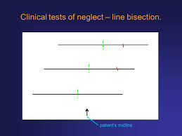 Check spelling or type a new query. Fundamentals Of Neuroscience Unilateral Neglect Lec 01 Ppt Download