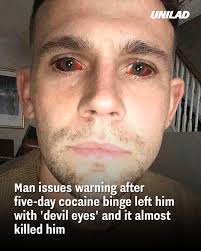 He wants people to be aware of the extreme side effects 😳