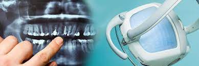 Not everyone can qualify for free dental implants. Questions To Ask At Your Free Dental Implants Consultation Lacey Wa