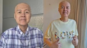 Doc Willie Ong, may deklarasyon sa lagay ng kalusugan-Balita