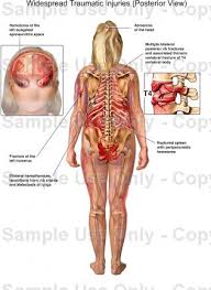 Anatomy of a human female back muscle anatomy human back diagram organs anatomie. Human Body Anatomy Rear View Human Body Anatomy