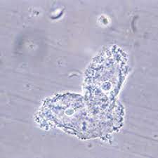 All women with symptoms of bacterial vaginosis should be treated. Effective Treatment Of Recurrent Bacterial Vaginosis Mdedge Obgyn