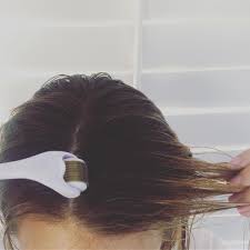 We did not find results for: Microneedling Might Be The Secret To Preventing And Treating Hair Loss Treat Hair Loss Hair Loss Remedies Hair Serum