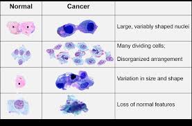 Normally, our cells follow these instructions and we stay healthy. Characteristics Of Cancer Cells