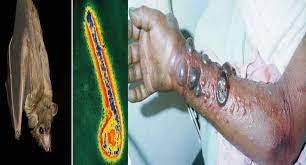 Marburg virus (marv), along with the ebola virus, belongs to the family of filovirus and is cause of a lethal and severely affecting hemorrhagic fever. Allugjnm3uuhnm