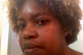 Fundraiser by Carrine Lovelace : Moyamoya Brain Revascularization Bypass  Surgery