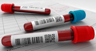 As provas, exames e respetivos critérios de classificação são documentos oficiais do iave. Dicas Importantes Como Se Preparar Para Os Exames De Sangue