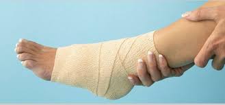 Ketahui apa saja penyebabnya demi menghindari terganggunya. Tips Mengobati Pergelangan Kaki Kesleo Simphony