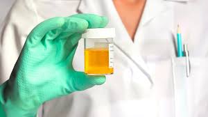 Image result for Urine Output