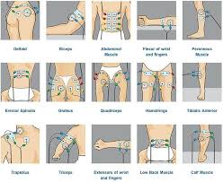 Ems Electrode Placement Chart Chart Tens Unit Placement