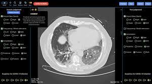 You are here » computed tomography. New Online Training To Quickly Upskill Ct Diagnosis Of Covid 19 Ge News