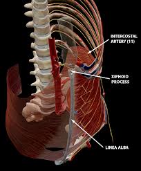 Elevation of the rib cage during inhalation occurs when. The Rectus Abdominis And Friends An Intro To The Ab Muscles