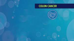The tumor develops in the lymph nodes or tissues that are near the original cancer. Treatment Of Stage Iv Metastatic Or Recurrent Colon Cancer Cancerconnect